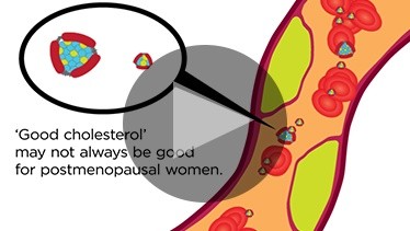 ‘Good Cholesterol’ May Not Always Be Good For Postmenopausal Women