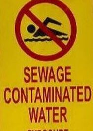 Sewage-contaminated runoff closes south county beaches, shorelines