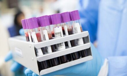 UC San Diego Health launches novel coronavirus blood testing to identify past exposure