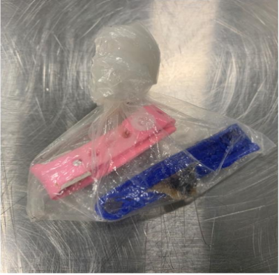 Border Protection agents discover a human umbilical cord in a passenger’s baggage