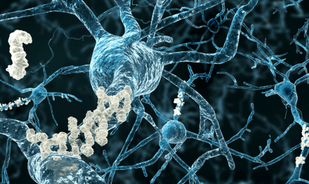 Why some brains with Alzheimer’s stay sharp