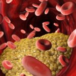 Investigational drug could control cholesterol