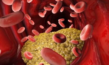 Investigational drug could control cholesterol