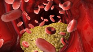 Investigational drug could control cholesterol